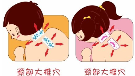 您还只是把退热贴贴于额头？那你就out了 小孩发烧