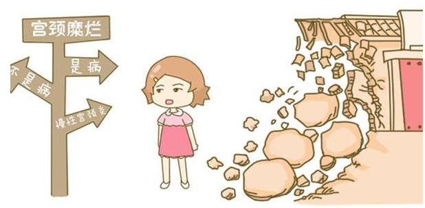 别被宫颈糜烂吓到了