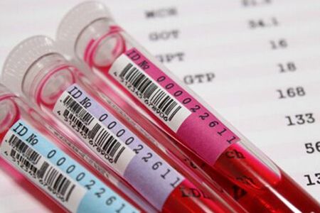 干货，教你如何看懂体检报告---血常规