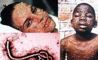 旅行中，必须要知道的这6种传染病