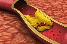 你一定不知道，很多人猝死是因为这里“长斑”