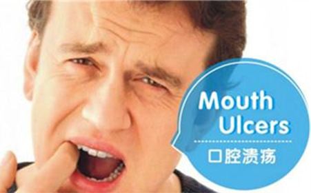 口腔溃疡怎么好得快？答案竟如此简单！